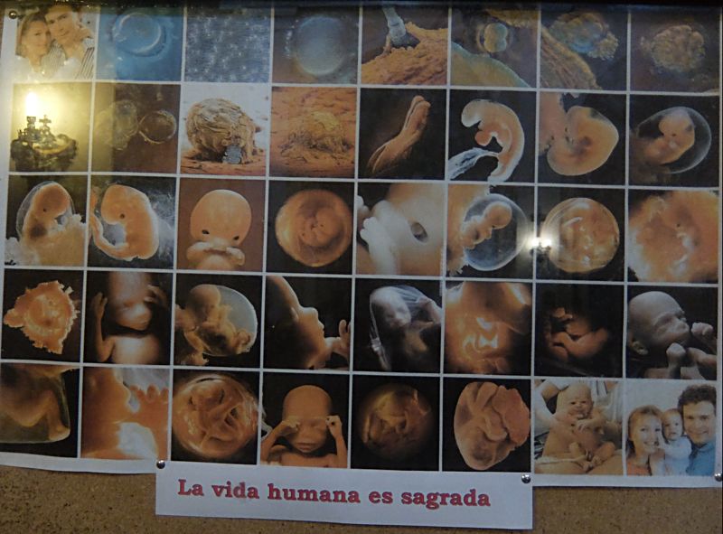 Развитие эмбриона от зачатия до рождения. Испания. Стенд в церкви. Фото Лимарева В.Н. 